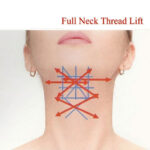 Neck 10 min